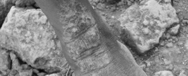 Ini adalah foto kaki salah satu orang dewasa yang terkenan pernyakit kulit setelah mandi di kali Leowalu. (Foto: G-Prok)