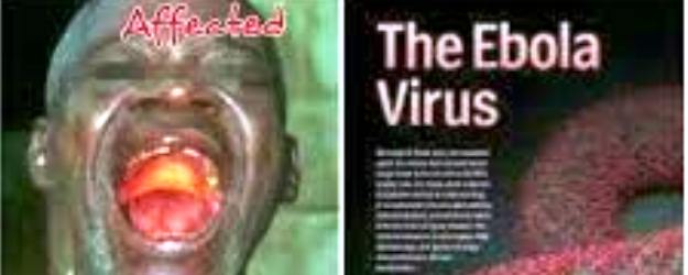 Korban Virus Ebola